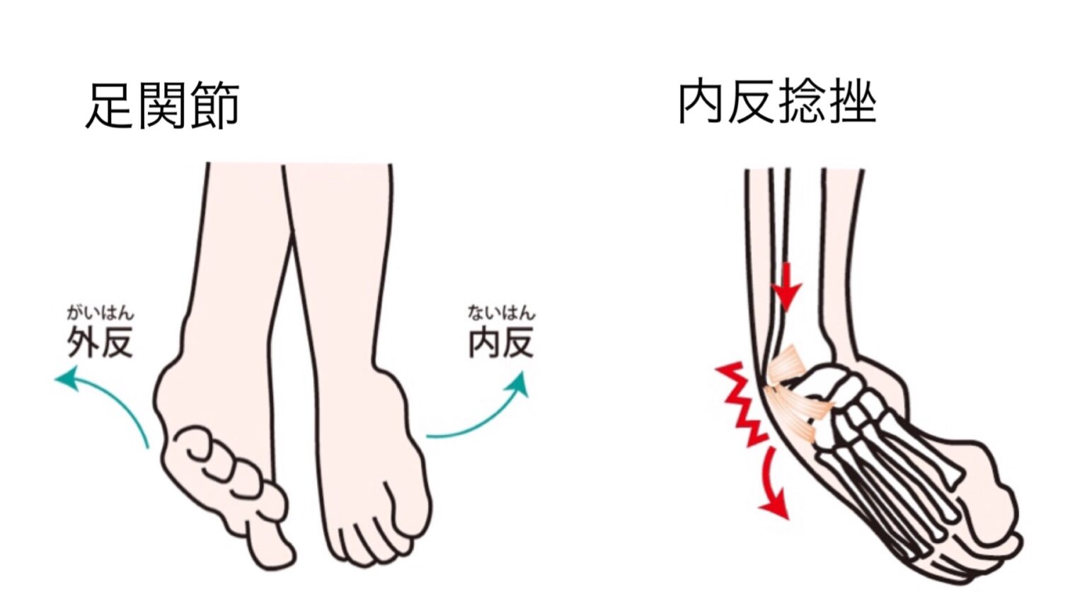 内反捻挫を繰り返さないための足首安定＆腓骨筋トレーニング | 明日カラキレイ！